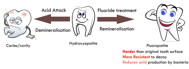 How fluoride works on teeth