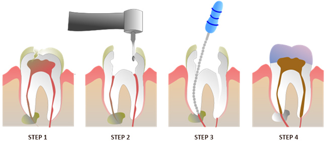 Restorative Dentistry Procedures