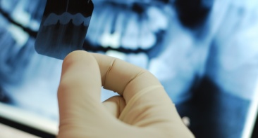 Dental Treatment - X-Ray