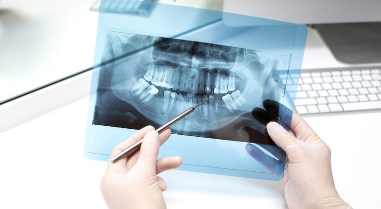 Painless Root Canal Treatment (RCT) Specialist in Mumbai, India