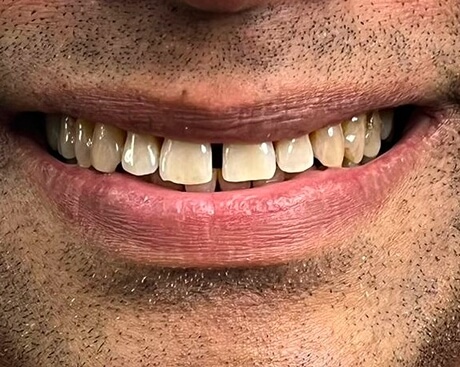 Frame 1272638878